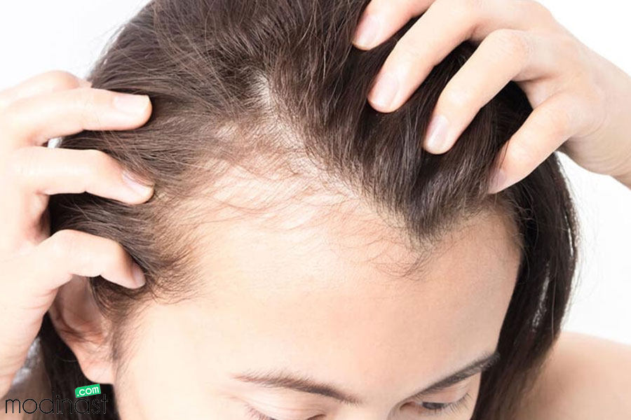 برای ریزش مو زینک بهتره یا بیوتین؟