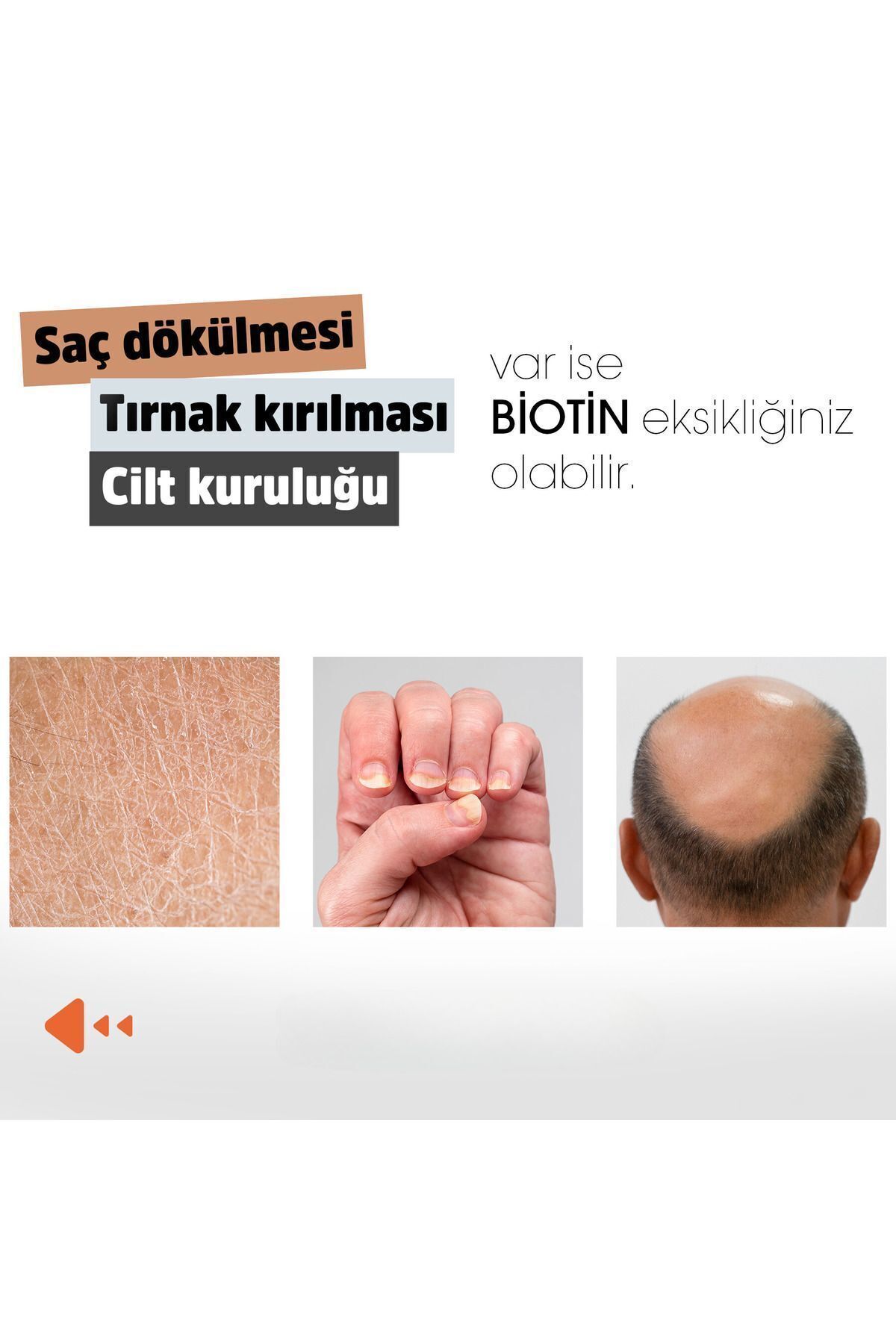 کپسول بیوتین (عصاره گزنه و بومادران ) Erbatab - بسته ۶۰ عددی